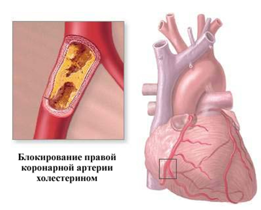 Где Находится Сердечная Мышца Фото